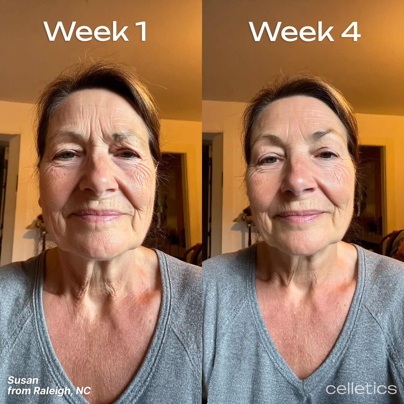 Astaxanthin Wrinkle Serum